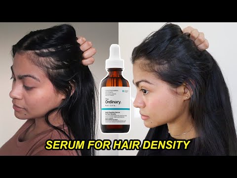 I tried The Ordinary Serum for Hair Density for 4...