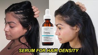 I tried The Ordinary Serum for Hair Density for 4 months & THIS HAPPENED! | Before and after results