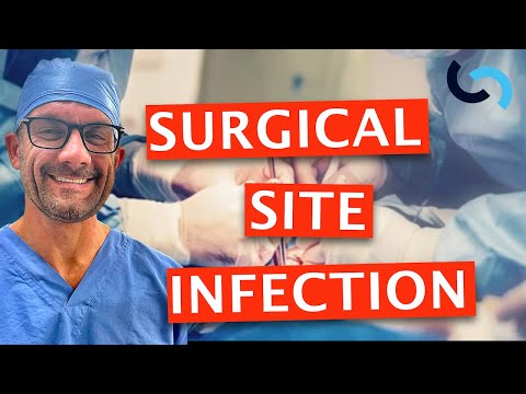 Diagnosis and Treatment of Surgical Site Infection