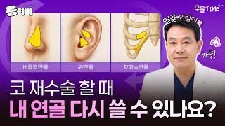 코 재수술 할 때, 내 연골 다시 쓸 수 있나요?｜코성형｜김종구 원장