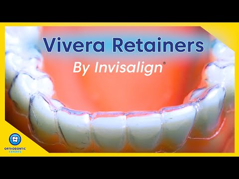 Are Vivera Retainers The Best Retainer Option?
