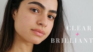 Facial Laser Treatment | Fading Acne Scars Review