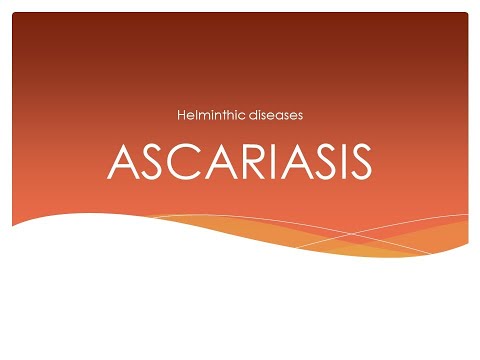 Az aszcariasis klinikai tünetei