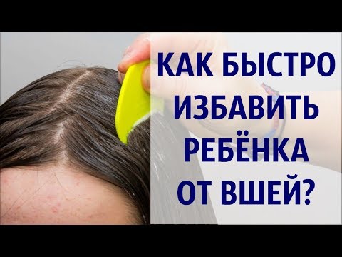 Как быстро избавить ребёнка от вшей / Педикулёз у ребенка