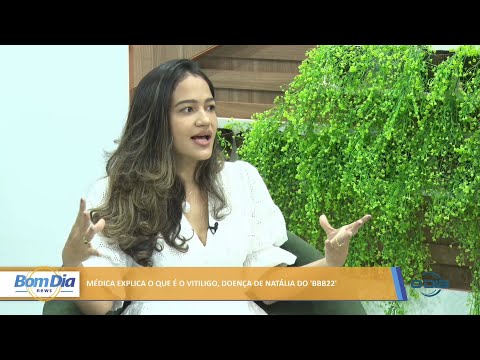 Médica explica o que é o vitiligo doença de Natália do “BBB 22” 03 02 2022