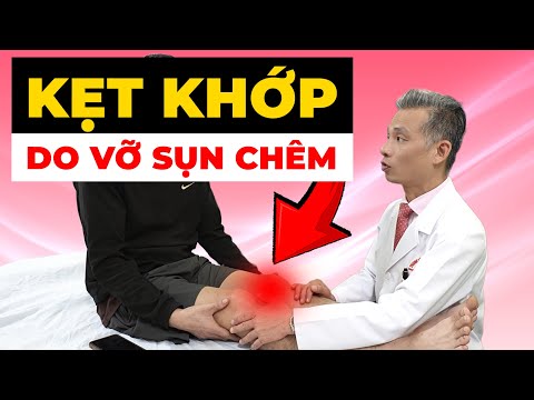 Khớp Gối Bị Kẹt, Đau Nhói? Dấu Hiệu Kẹt Khớp Do Vỡ Sụn Chêm Độ 3
