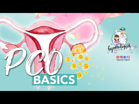 PCO Syndrome Basics
