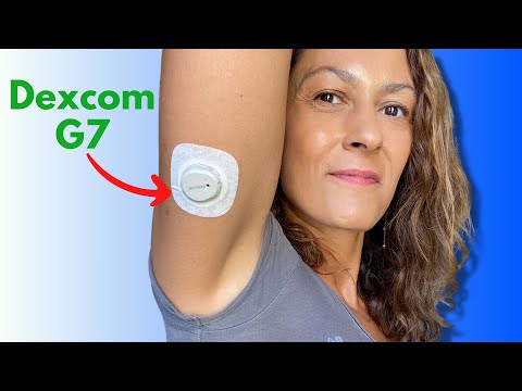 Dexcom G7 UPDATED Review - What I Learned After 2 Years of Use