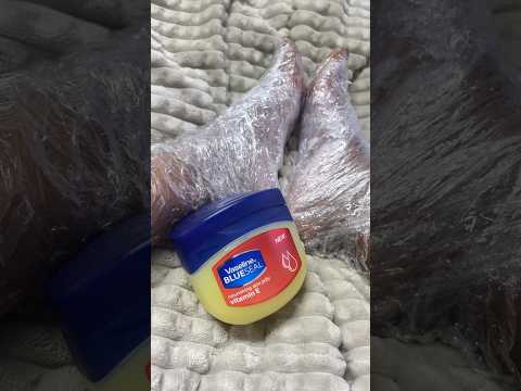 Foot Care- How to get rid of dry feet and peeling heels #youtubeshorts