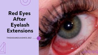 Red Eyes after Eyelash Extensions
