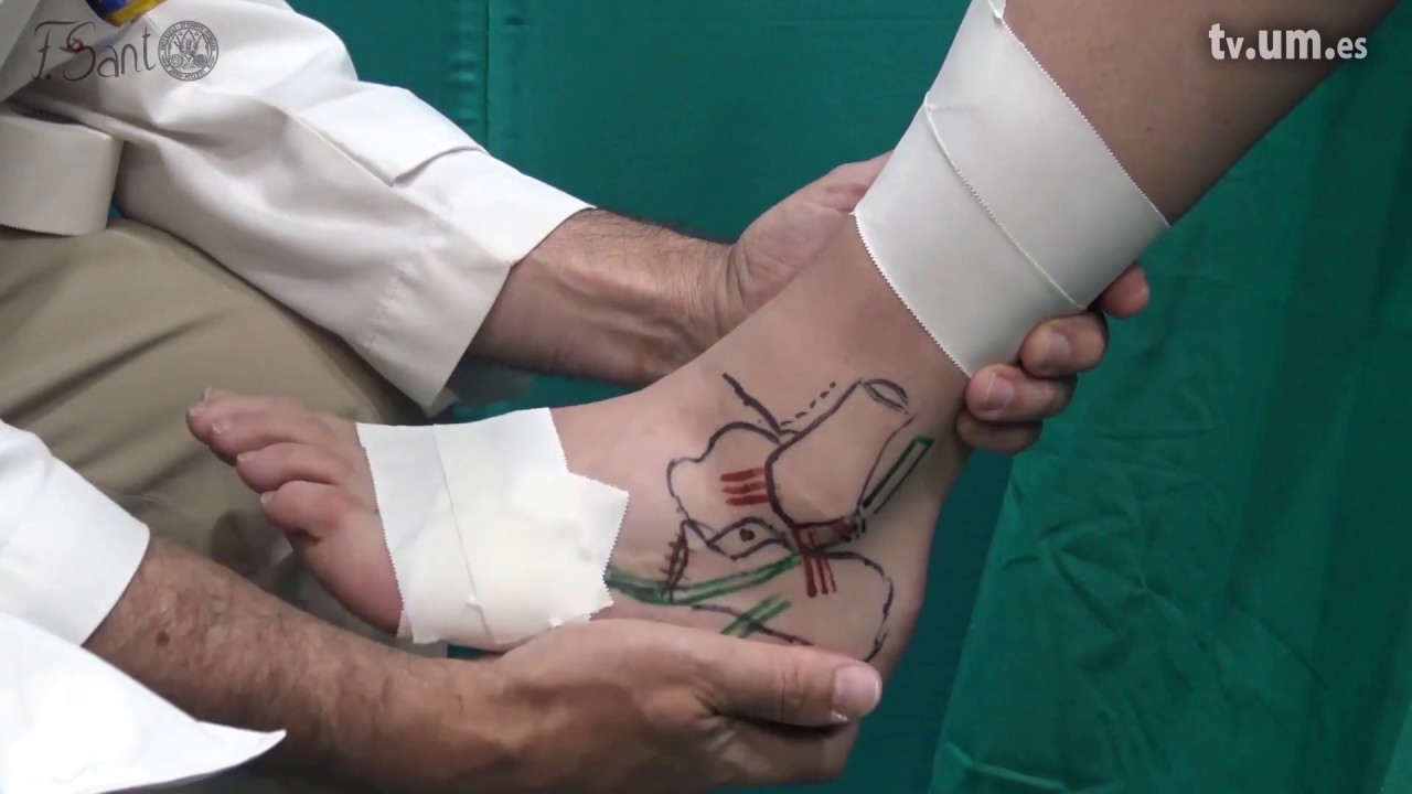 Watch Vendaje funcional del ligamento lateral externo 1920x1080 1137451 Now Vendaje funcional del ligamento lateral externo 1920x1080 1137451