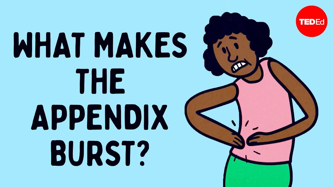 What does appendix pain feel like? - David R. Flum - YouTube