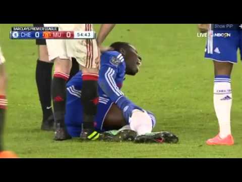 Kurt Zouma Horrible Injury vs Man United.07|02|2016