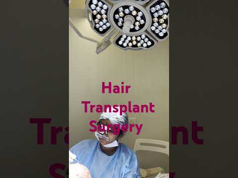Hair Transplant | Beyond Aesthetic