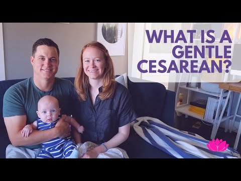 What Is A Gentle C Section?