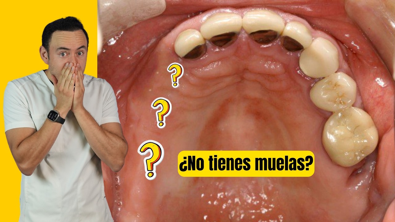 Esto le pasa a tu cuerpo al perder las muelas | ¡Te quedarás con la boca abierta!