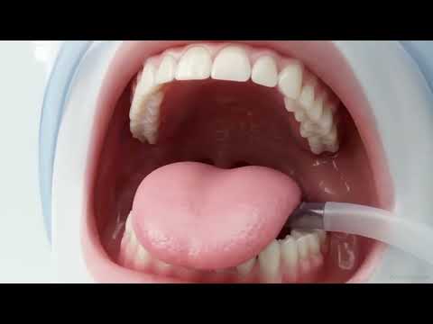 PROCEDIMIENTOS DE ENFERMERIA EN HIGIENE ORAL CLINICA