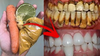 Clareamento dentario em um minuto e meio, Como clarear os dentes em casa