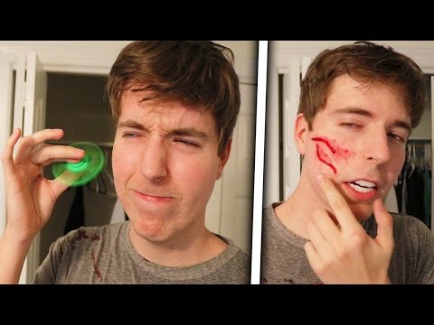 Fidget Spinner Vs Face (Legit Had To Get Stitches)