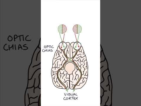 Understanding the Causes of Vertigo