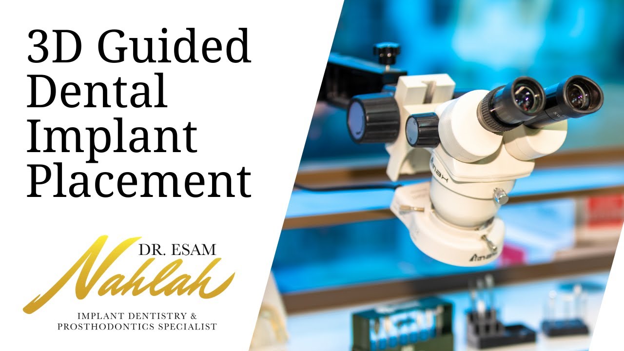 Eliminate The Risk Of Human Error With 3D Guided Dental Implant Placement — video thumbnail