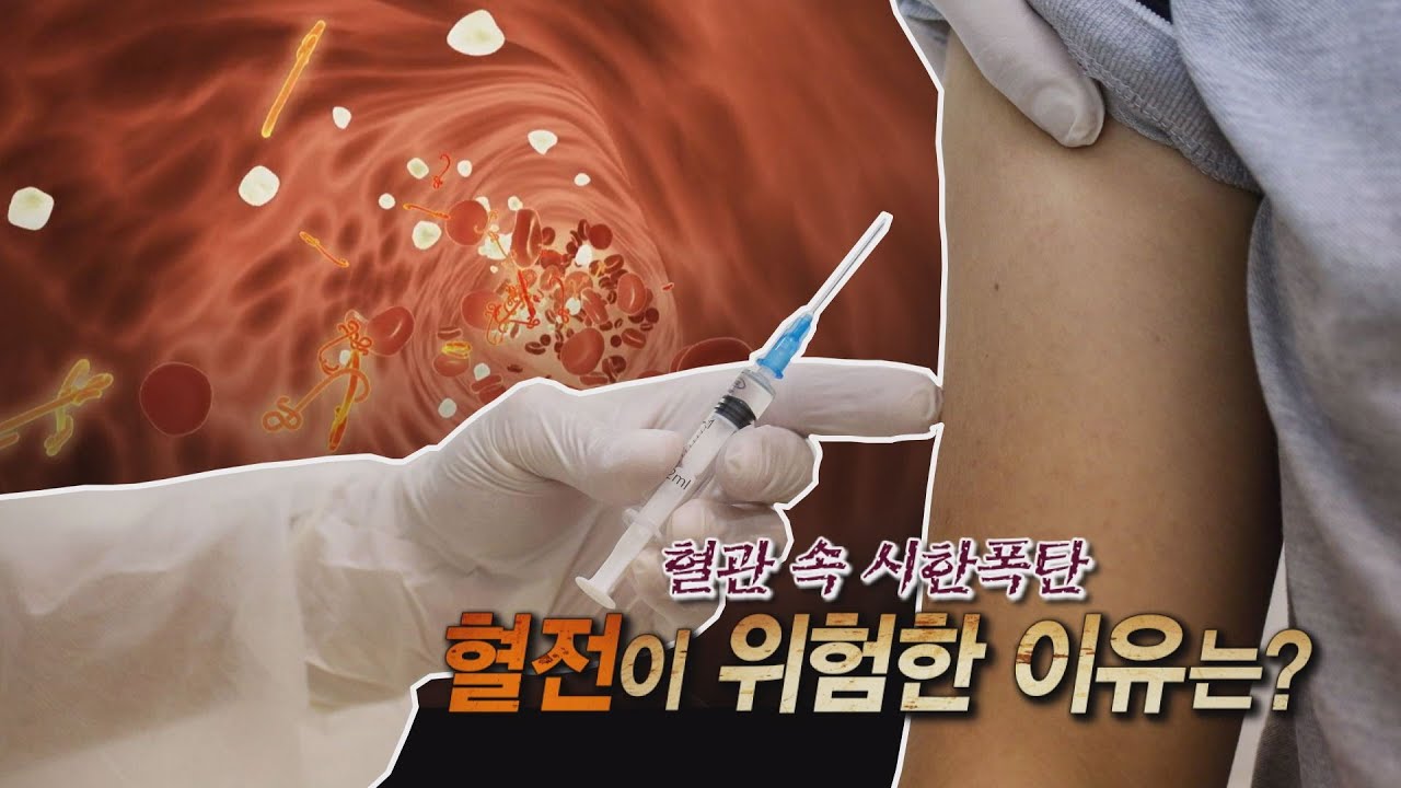 혈전의 원인과 예방 | 심장내과 윤혁준 교수 관련사진