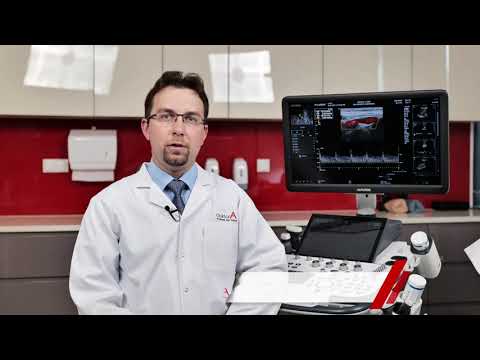 Badanie USG doppler tętnic szyjnych