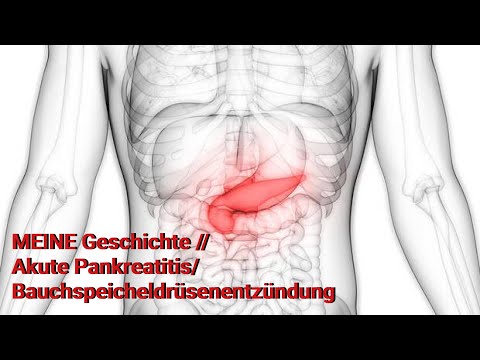 MEINE Geschichte // Akute Pankreatitis/Bauchspeicheldrüsenentzündung