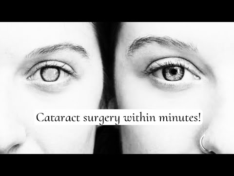 Micro-Incision Cataract Surgery
