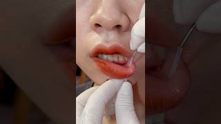 Download lagu Lip piercing Episode 1 mp3 Download lagu Lip piercing Episode 1 mp3