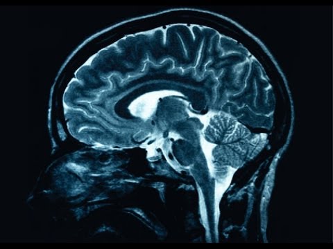 Ученые из MIT создали технологию трехмерного сканирования активности нейронов. Фото.