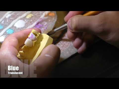 Видео с курса, нанесение керамика one bake. Воспроизведение возрастного зуба,трещины в эмали