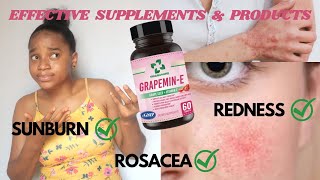 HOW TO GET RID OF FACE REDNESS || Effective Foods & Supplements, Skincare Products, Do