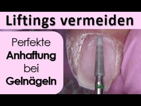 Klotrimasol die Salbe von gribka der Nägel auf den Händen Schon das Jahr kann ich von gribka der Nägel nicht entgehen