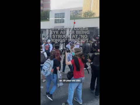 Student loses eye after being struck at ‘No Kings’ protest