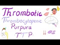 Thrombotic Thrombocytopenic Purpura (TTP) Thrombotic Thrombocytopenic Purpura (TTP)