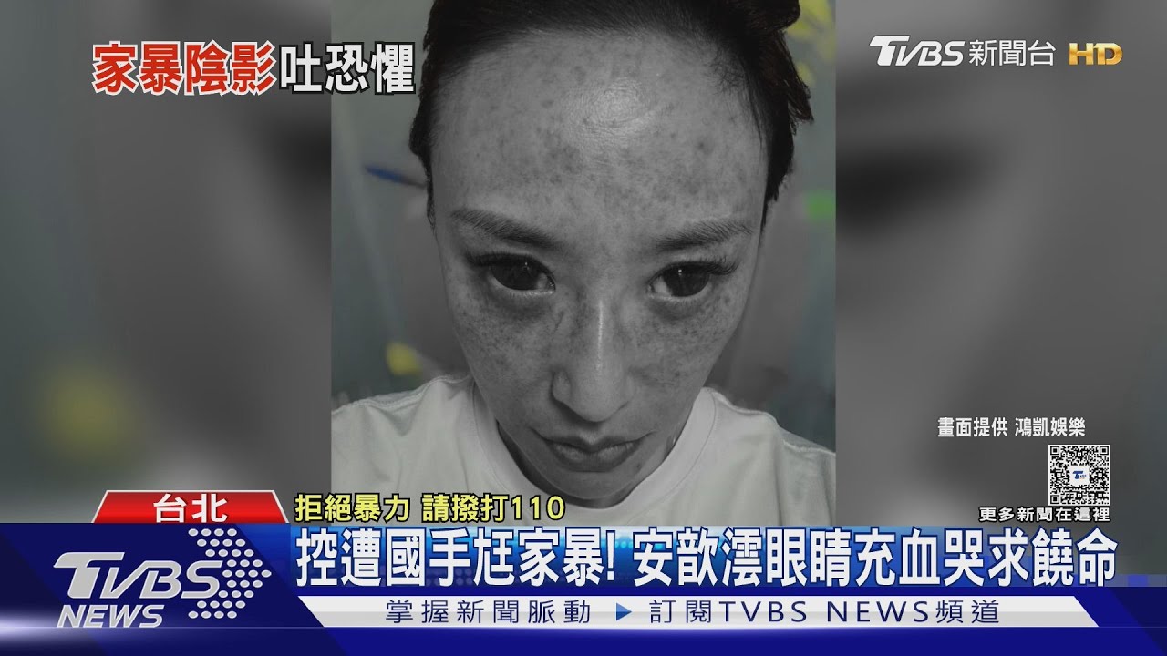控國手尪出軌+家暴！安歆澐「車裡被掐脖、眼睛充血」請求饒命