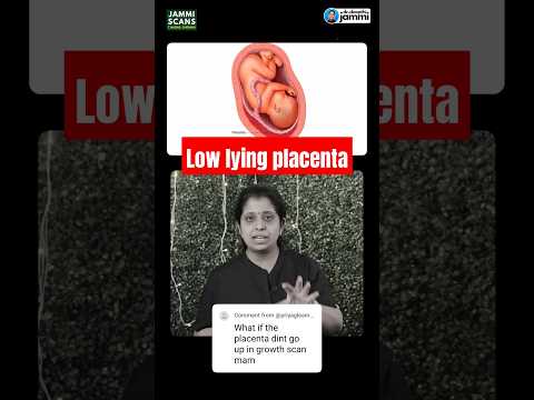 Low lying placenta #shorts #placentaprevia #pregnancy