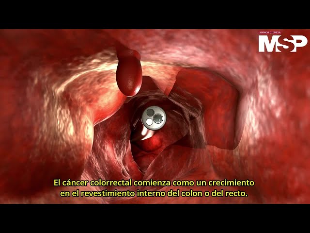 Vídeo relacionado con WANDIC 50 colgantes de cinta azul, cáncer de colon, cáncer de próstata, cáncer colorrectal, dijes de cinta de aleación de conciencia de esperanza para hacer joyas