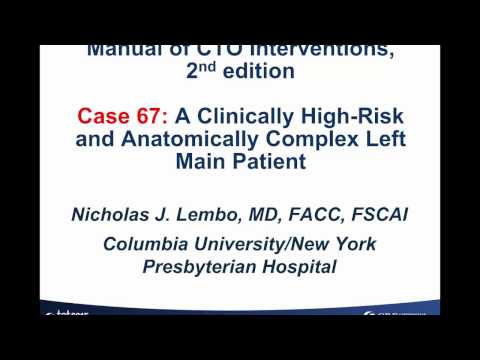 Case 67: Manual of CTO Interventions - VA ECMO supported CTO PCI