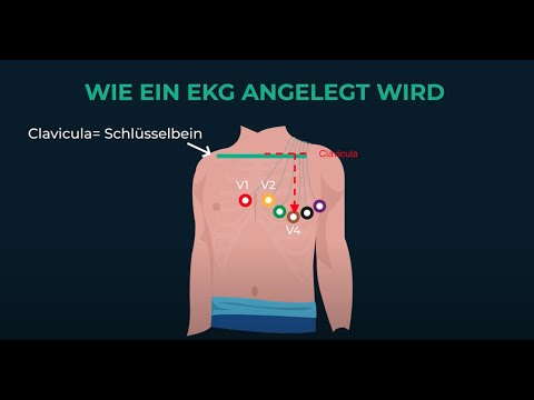 EKG anbringen einfach erklärt | Novaheal