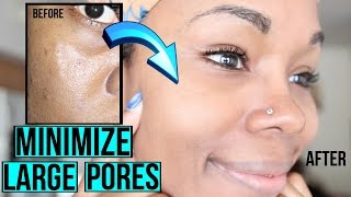 How to Get Rid of Large Pores LIKE A BOSS! | Easy Regimen & AT HOME REMEDIES