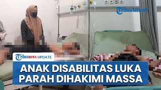 Kronologi Anak Disabilitas Luka Parah usai Dikeroyok & Dihakimi Warga di Karawang gegara Salah Paham