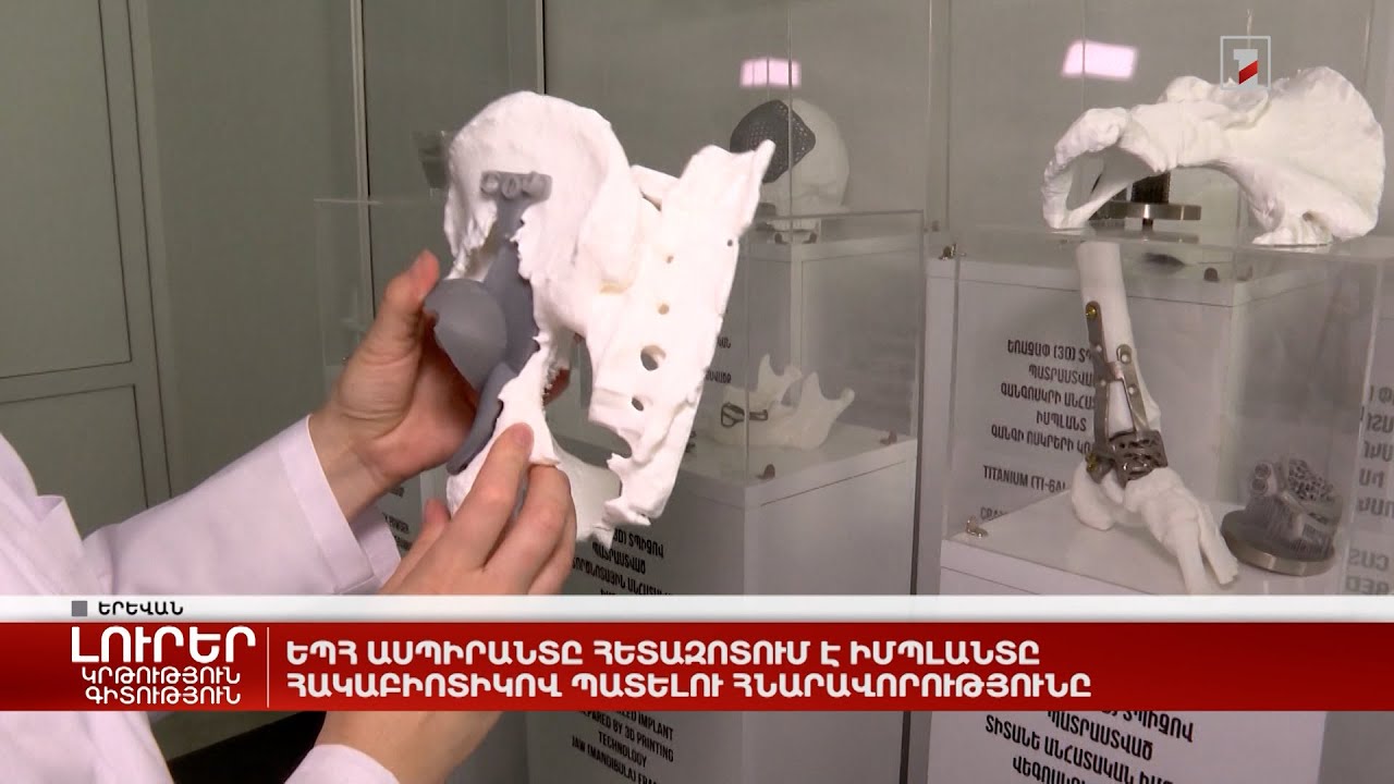 ԵՊՀ ասպիրանտը հետազոտում է իմպլանտը հակաբիոտիկով պատելու հնարավորությունը