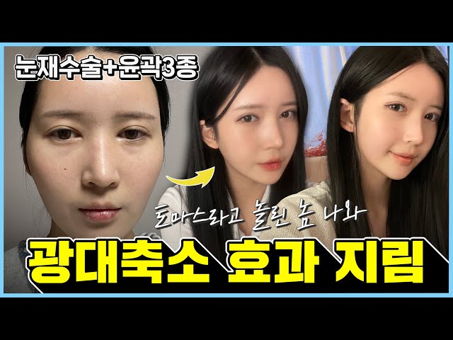 에이비성형외과의원 에이비성형외과의원