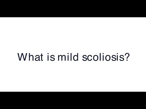 A gerincferdülés (scoliosis) tünetei és kezelése