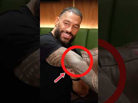 Roman Reigns Is Double Jointed 😲 #wwe #romanreigns #wweraw #smackdown #shorts