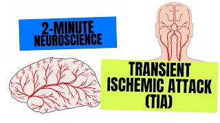 2-Minute Neuroscience: Transient Ischemic Attack (TIA)