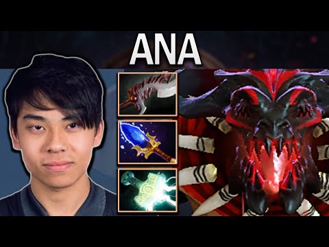 Bloodseeker Dota 2 Gameplay Ana with 28 Kills - Mjolnir