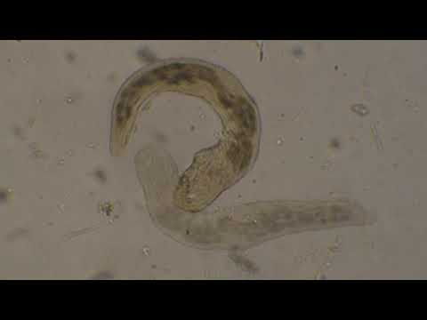amoeboid paraziták a férgek miatt nincs megtermékenyítés